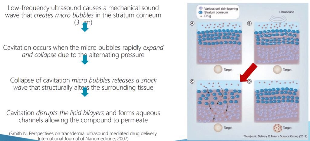 Alma TED uses low-frequency ultrasonic sound waves and air pressure to drive topical hair growth treatments deep into the skin through a process known as acoustic cavitation, also referred to as sonophoresis or phonophoresis. This innovative approach breaks through the outermost layer of the skin, the stratum corneum, which serves as a protective barrier. This layer is formed by a "brick and mortar" structure of corneocytes (cells) bonded together by lipids, which prevent large molecules and moisture from penetrating the skin.   The ultrasonic sound waves operate at a specific frequency, generating tiny, temporary gaseous bubbles that expand and collapse within the skin’s surface, gently disrupting this barrier and allowing active ingredients to pass through. Simultaneously, the mechanical pressure of these sound waves creates a push-pull effect that enhances the delivery of treatment compounds through the skin’s surface to reach the hair follicles below. Through this TransEpidermal Delivery (TED) process, Alma TED significantly increases the absorption of topical hair growth treatments, enabling more active ingredients to reach the follicles, where they can promote hair strength, health, and growth. Alma TED’s proprietary Hair Care Formula, developed in collaboration with a leading pharmaceutical company, contains essential nutrients like protein growth factors, peptides, and amino acids to improve hair strength and shine.